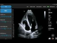 3.6MHz পোর্টেবল ওয়্যারলেস আল্ট্রাসাউন্ড প্রোব ফেজড অ্যারে ট্রান্সডুসার