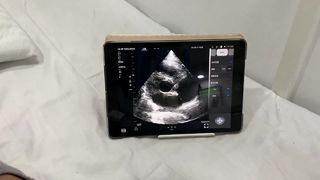 কার্ডিয়াক এবং POCUS এর জন্য ডুয়াল হেড ওয়্যারলেস আল্ট্রাসাউন্ড প্রোব