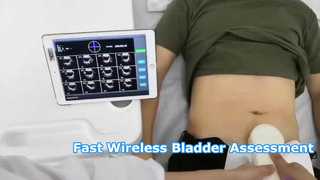 ওয়্যারলেস 4D ব্লাডার স্ক্যানার BS1 পোর্টেবল পয়েন্ট অফ কেয়ার