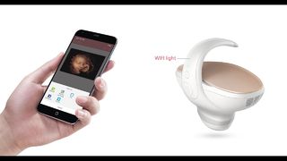 Marvoto Fetus Camera M1- 3D হ্যান্ডহেল্ড আল্ট্রাসাউন্ড