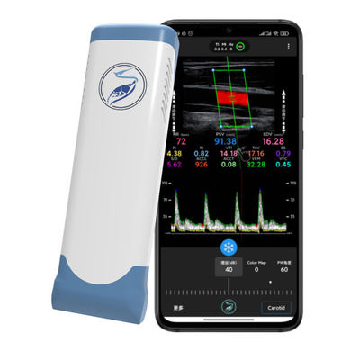 কেনা iPhone এবং iPad এর জন্য 12MHz ওয়্যারলেস হ্যান্ডহেল্ড আল্ট্রাসাউন্ড স্ক্যানার | ইলেকট্রনিক লিনিয়ার অ্যারে কালার ডপলার প্রোব online manufacture