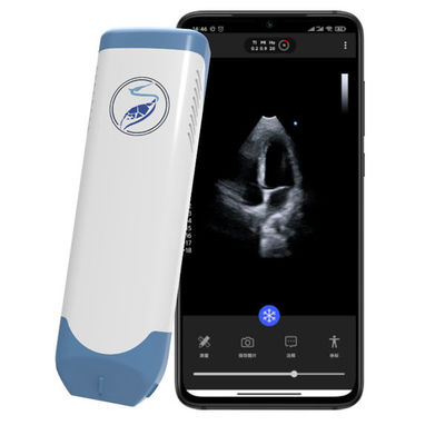 কেনা POCUS ইকোকার্ডিওগ্রাফির জন্য ওয়্যারলেস ফেজড অ্যারে হ্যান্ডহেল্ড আল্ট্রাসাউন্ড স্ক্যানার 5MHz পকেট কার্ডিয়াক আল্ট্রাসাউন্ড online manufacture