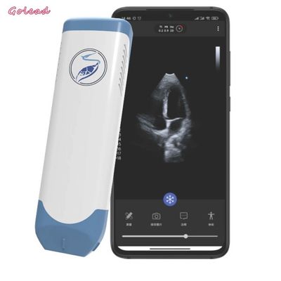 কেনা 3.6MHz পোর্টেবল ওয়্যারলেস আল্ট্রাসাউন্ড প্রোব ফেজড অ্যারে ট্রান্সডুসার online manufacture