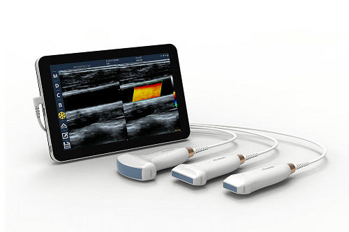 কেনা ভাস্কুলার এবং POCUS এর জন্য USB Type-C লিনিয়ার হ্যান্ডহেল্ড আল্ট্রাসাউন্ড স্ক্যানার 10MHz পোর্টেবল অ্যান্ড্রয়েড আল্ট্রাসাউন্ড প্রোব online manufacture