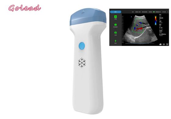 কেনা POCUS পরীক্ষার প্রাথমিক যত্নের জন্য এনেস্থেশিয়া আইপ্যাড ওয়্যারলেস আল্ট্রাসাউন্ড প্রোব online manufacture