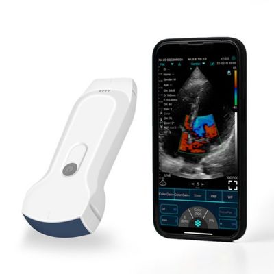 কেনা ক্লিনিকাল রোগ নির্ণয়ের জন্য POCUS পোর্টেবল আইপ্যাড হ্যান্ডহেল্ড আল্ট্রাসাউন্ড স্ক্যানার online manufacture