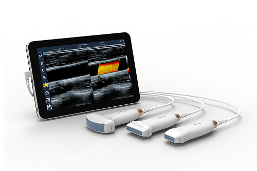 ভাস্কুলার এবং POCUS এর জন্য USB Type-C লিনিয়ার হ্যান্ডহেল্ড আল্ট্রাসাউন্ড স্ক্যানার 10MHz পোর্টেবল অ্যান্ড্রয়েড আল্ট্রাসাউন্ড প্রোব