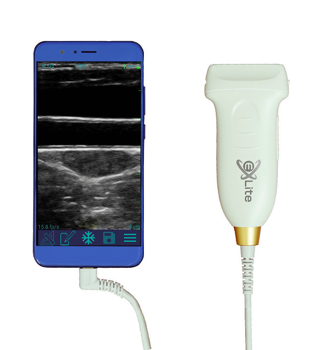 ভাস্কুলার এবং POCUS এর জন্য USB Type-C লিনিয়ার হ্যান্ডহেল্ড আল্ট্রাসাউন্ড স্ক্যানার 10MHz পোর্টেবল অ্যান্ড্রয়েড আল্ট্রাসাউন্ড প্রোব