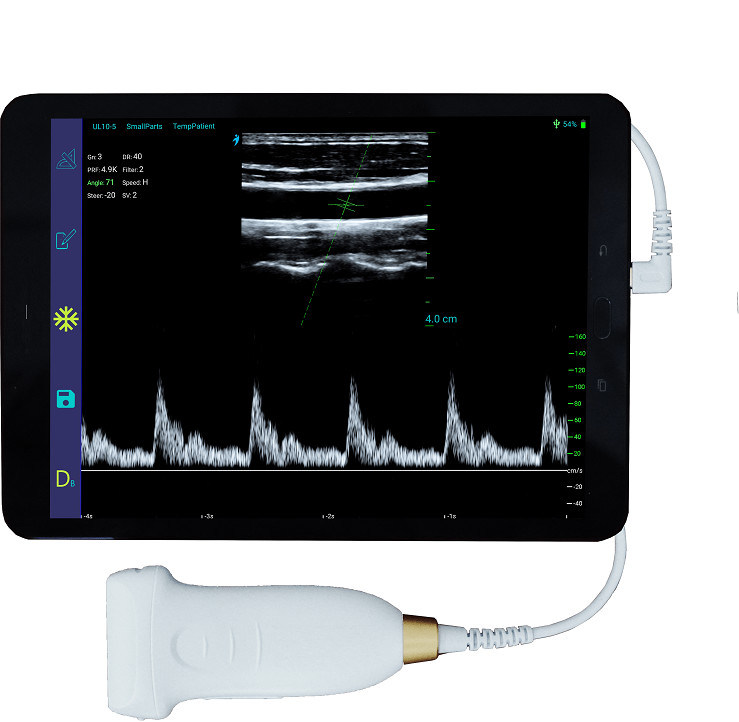 ভাস্কুলার এবং POCUS এর জন্য USB Type-C লিনিয়ার হ্যান্ডহেল্ড আল্ট্রাসাউন্ড স্ক্যানার 10MHz পোর্টেবল অ্যান্ড্রয়েড আল্ট্রাসাউন্ড প্রোব